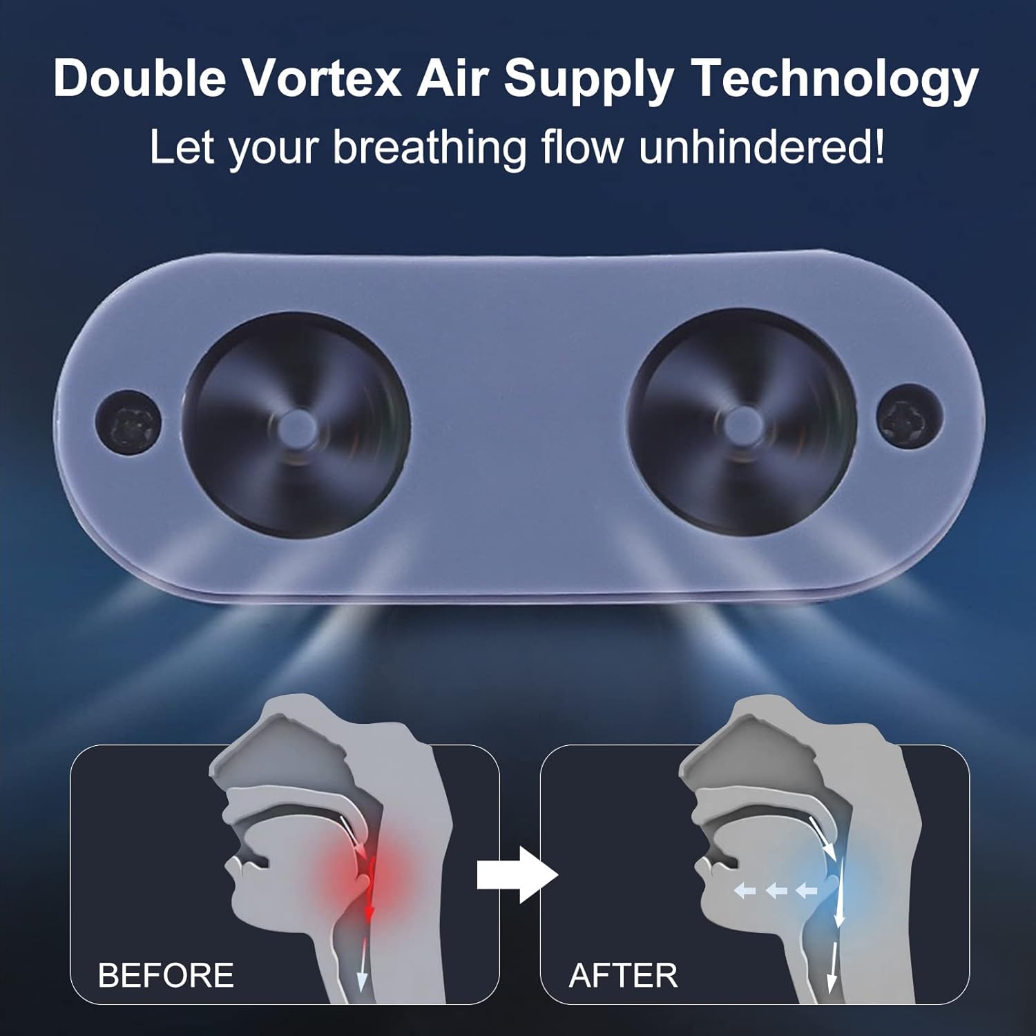 Micro Nasal Anti-Snoring Sleep Device